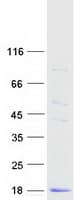 Human Cystatin SA / CST2 Protein (Recombinant Myc-DDK (Flag))