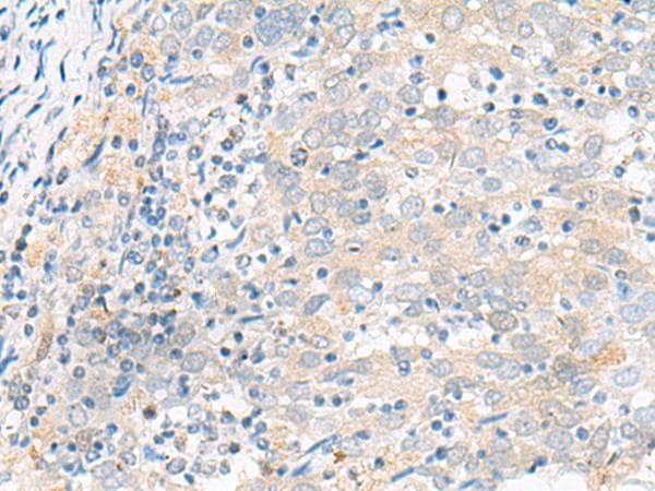 FGR Antibody
