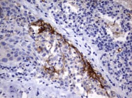 CD30 Antibody (clone OTI18D3)