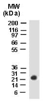 BAG2 Antibody