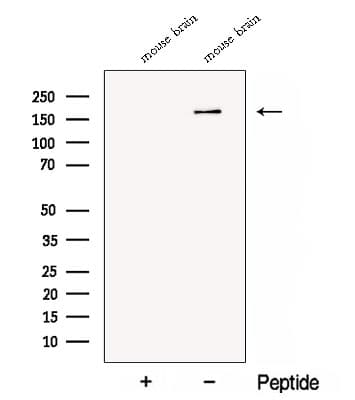 CTTNBP2 Antibody