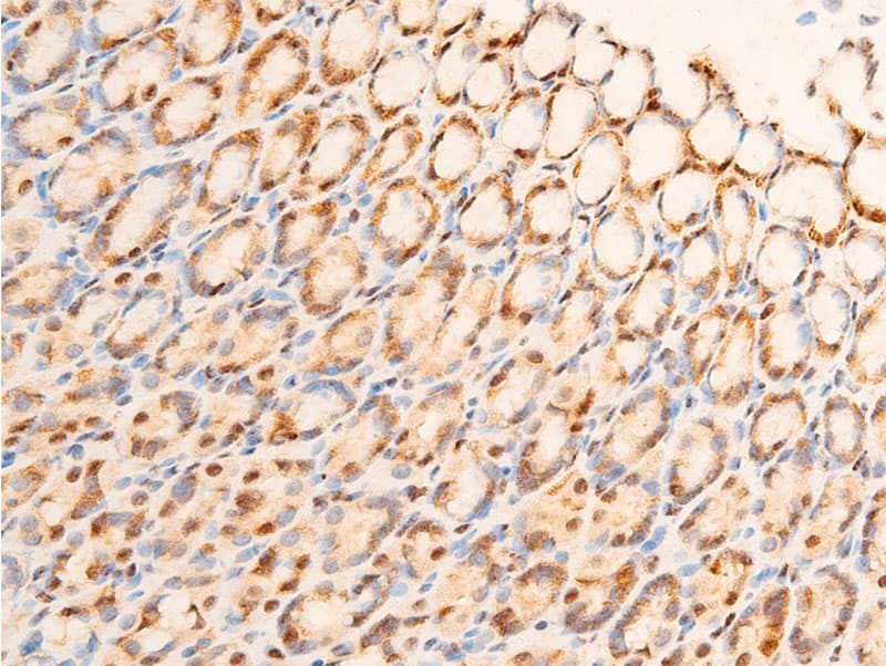 JUN / c-Jun Antibody (phospho-Ser63)