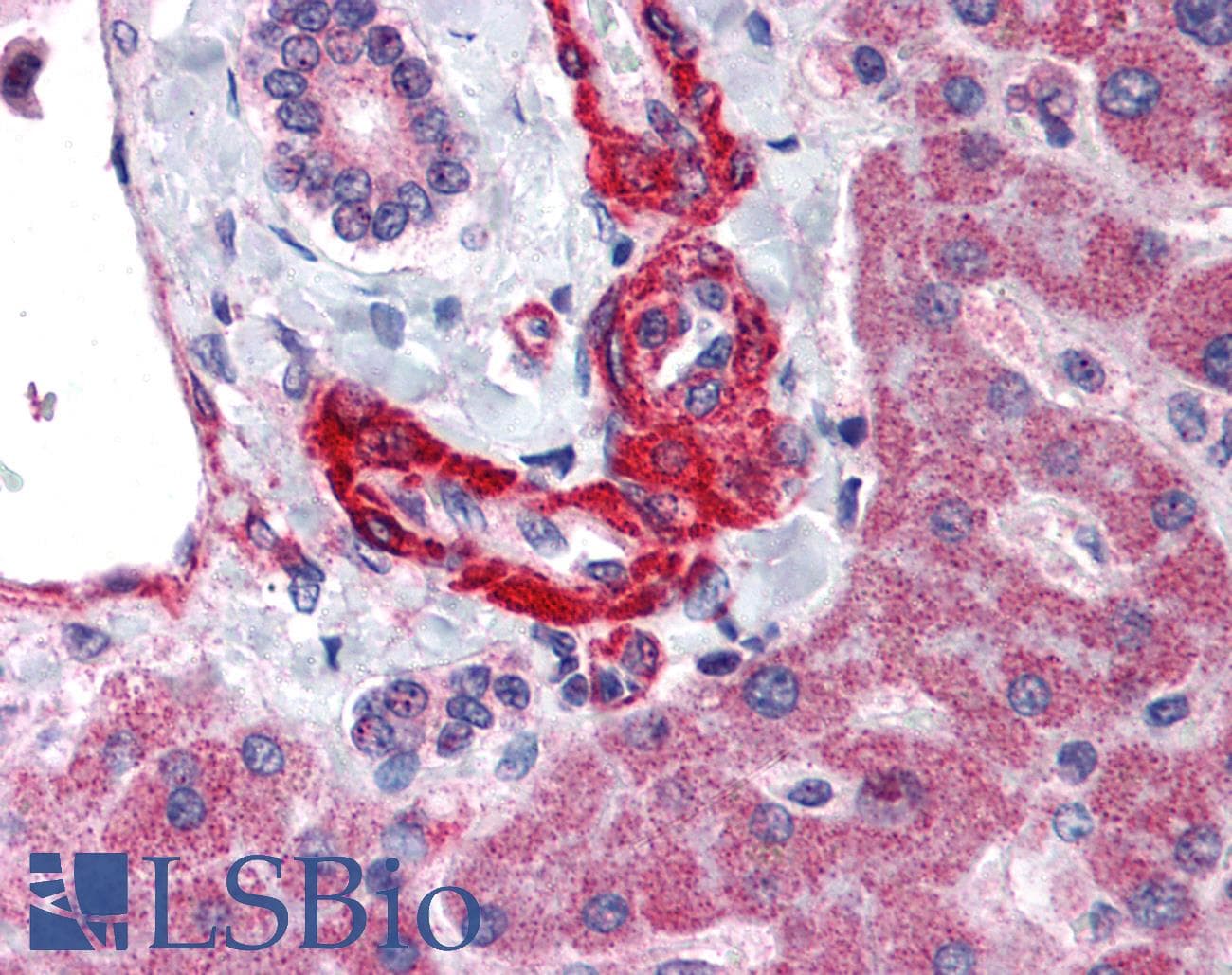 IHC-plus™ Polyclonal Rabbit anti-Human AGT / Angiotensinogen Antibody (Internal, IHC)