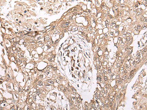 M1AP Antibody