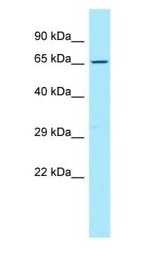 CD96 / TACTILE Antibody (aa429-478)