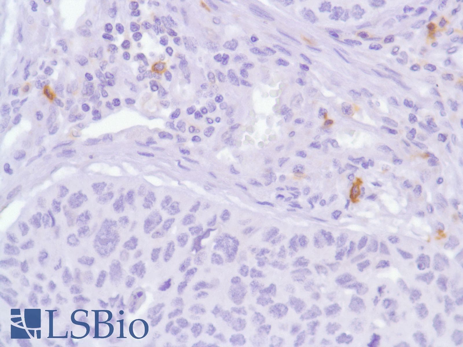 ICOS / CD278 Antibody (C-Terminus, clone SP98)