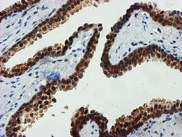 FBXO21 Antibody (clone OTI5H4)