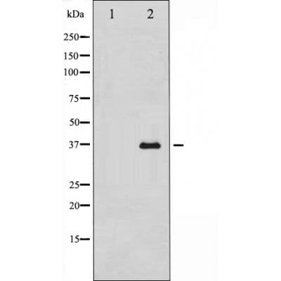 Polyclonal Rabbit anti-Human UCP2 Antibody (IHC, IF, WB)