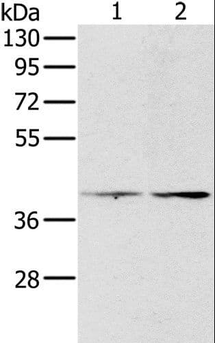 PRLTS / PDGFRL Antibody