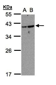 Polyclonal Rabbit anti-Human ARL14 Antibody (aa1-192, IHC, WB)