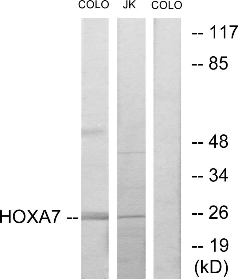 HOXA7 Antibody (aa91-140)