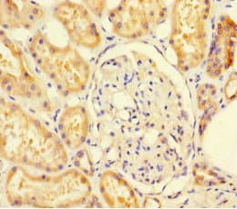 Polyclonal Rabbit anti-Human SUOX / Sulfite Oxidase Antibody (IHC, WB)