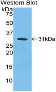 CA3 / Carbonic Anhydrase III Antibody (aa2-260, APC)
