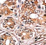 RB1 / Retinoblastoma / RB Antibody (phospho-Ser780)
