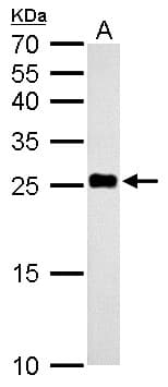 NDUFV2 Antibody (aa1-249)