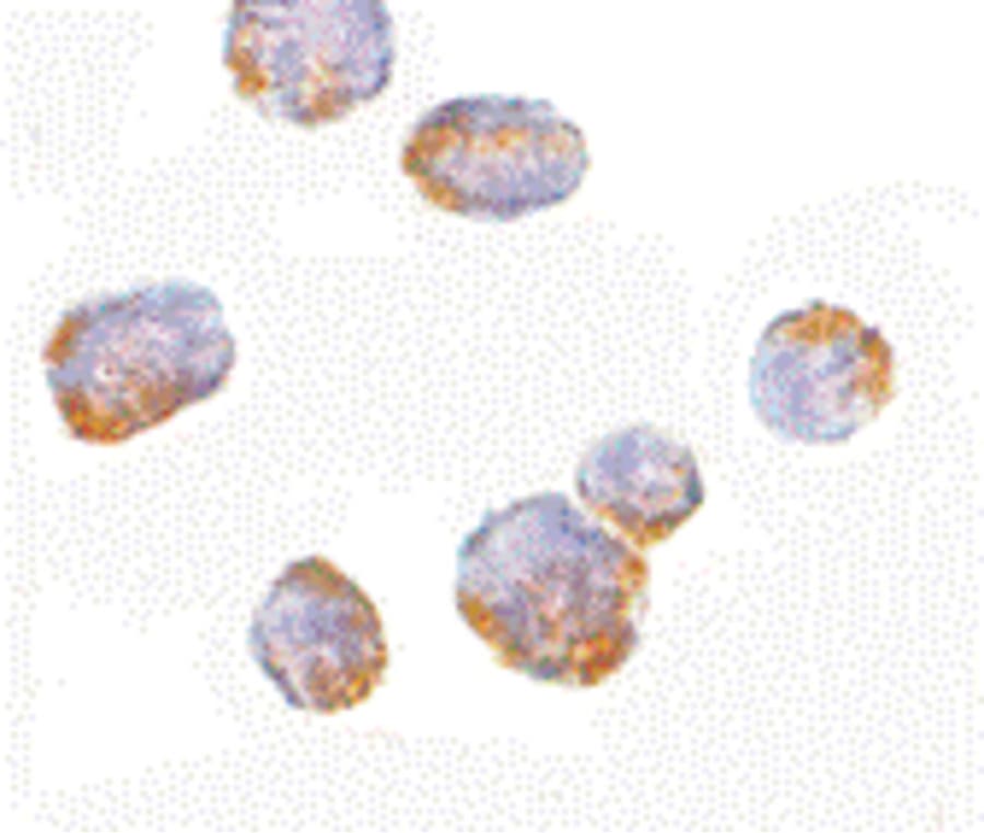 Polyclonal Rabbit anti-Human HCCS1 / VPS53 Antibody (IF, WB)