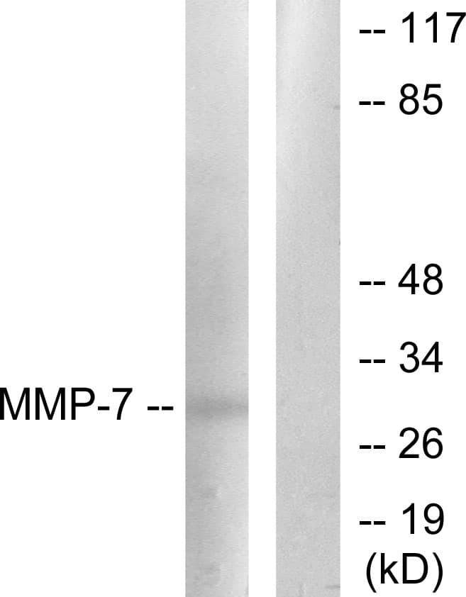 IHC-plus™ MMP7 / Matrilysin Antibody (aa218-267)
