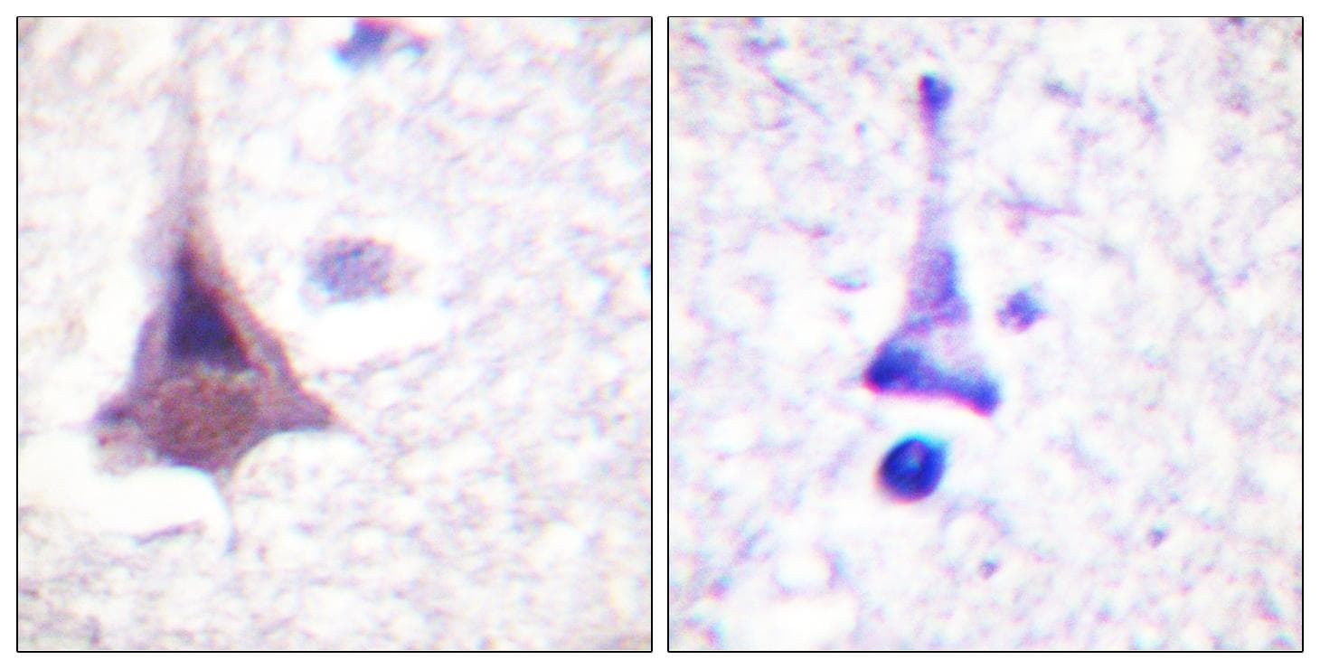 Polyclonal Rabbit anti-Human PPP1R12A / MYPT1 Antibody (p853, IHC, WB)