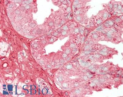 Polyclonal Rabbit anti-Human ALB / Serum Albumin Antibody (IHC, WB)