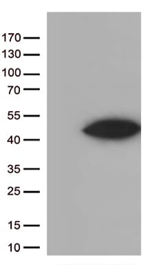 ARG1 / Arginase 1 Antibody (clone OTI2E7)