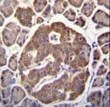 MAP3K13 / LZK Antibody (Ser869)