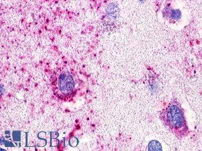 PathPlus™ Polyclonal Rabbit anti-Human GPR173 / SREB3 Antibody (N-Terminus, IHC)