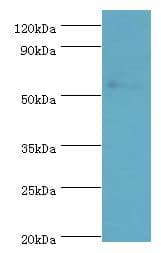 Polyclonal Rabbit anti-Human PRKAG3 / AMPK Gamma 3 Antibody (aa1-210, WB)