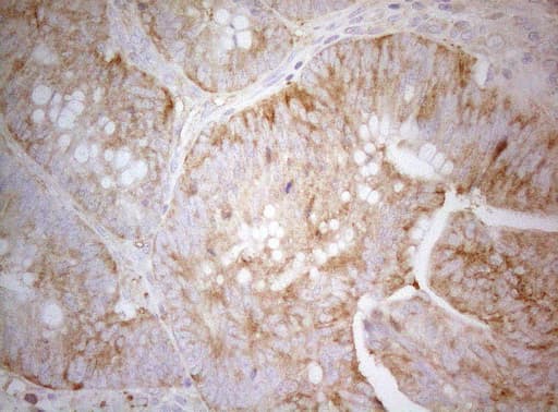 TWF1 / PTK9 Antibody (aa140-384, clone OTI5C12)