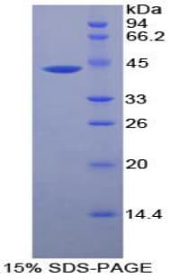 Human CKM / Creatine Kinase MM Protein (Recombinant His)