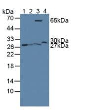 GSTT2 Antibody (aa16-242)
