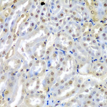 Polyclonal Rabbit anti-Human TUSC2 / FUS1 Antibody (IHC, IF, WB)