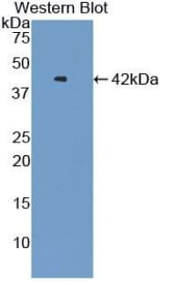 VTCN1 / B7-H4 Antibody (aa153-241, Biotin)