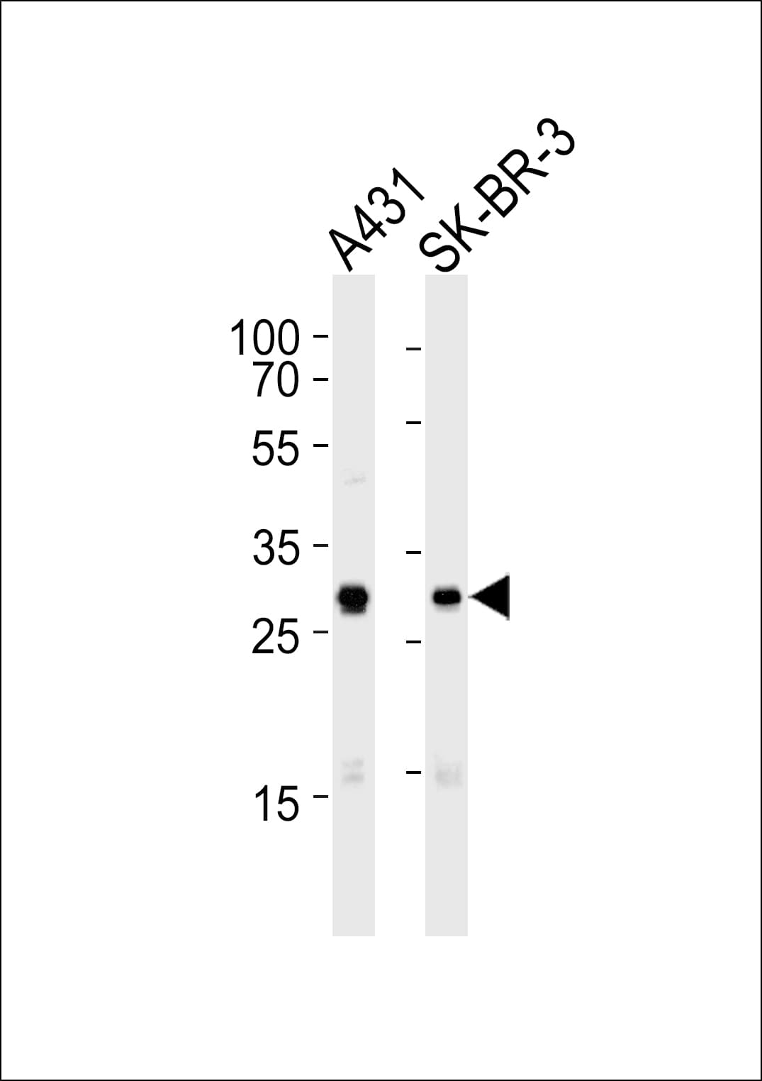 CDK1 / CDC2 Antibody (aa269-297)