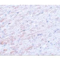 Polyclonal Rabbit anti-Human TCF3 / E2A Antibody (IHC, IF, WB)