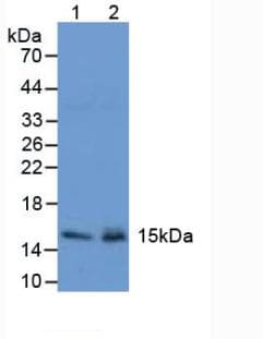TFF2 / SP Antibody (aa25-127)