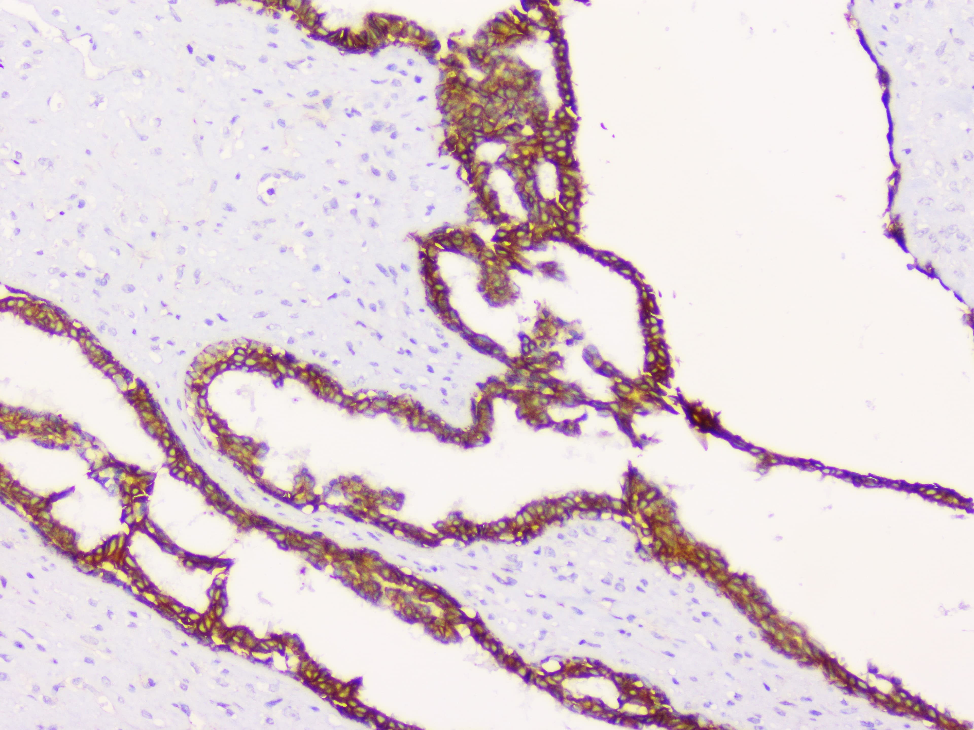 CTNNB1 / Beta Catenin Antibody
