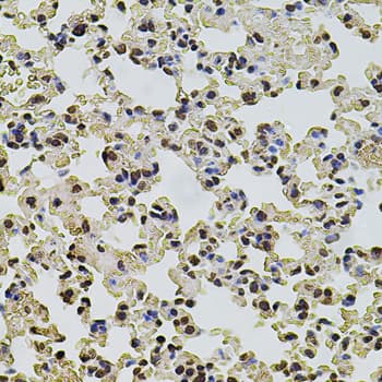 POT1 Antibody