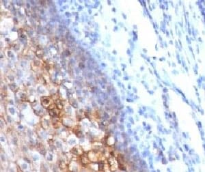 MCAM / CD146 Antibody (clone CDLA146)