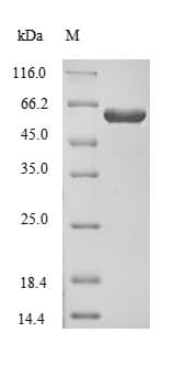 Human CRMP1 Protein (Recombinant)