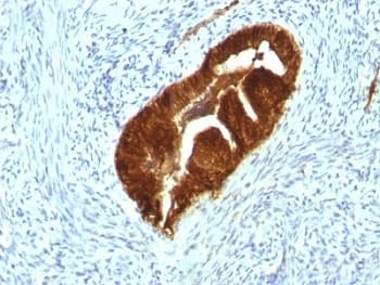 KRT19 / CK19 / Cytokeratin 19 Antibody (clone KRT19/799 + KRT19/800, Azide-free, BSA-free)