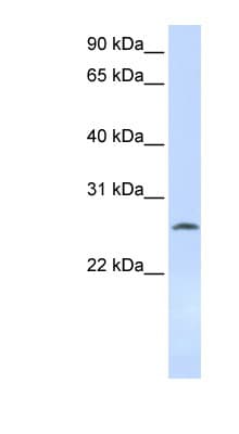 DCK / Deoxycytidine kinase Antibody (aa108-157)