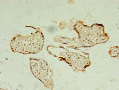 Polyclonal Rabbit anti-Human PGAM5 Antibody (IHC, IF)