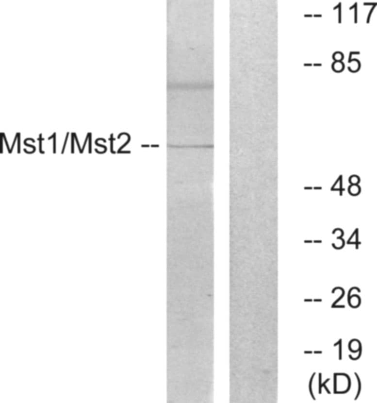 Polyclonal Rabbit anti-Human MST1 + MST2 Antibody (aa149-198, IHC, WB)