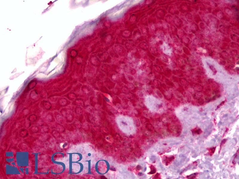 IHC-plus™ GPNMB / Osteoactivin Antibody (clone 3A5)