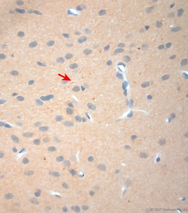 NGF Antibody (aa130-180)