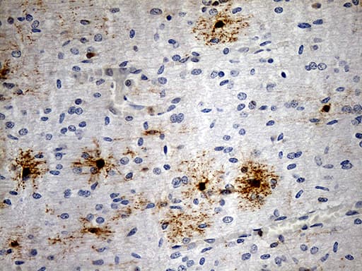 GPR17 Antibody (C-Terminus, clone OTI6A3)