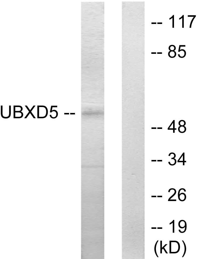 UBXN11 / SOC Antibody (aa131-180)