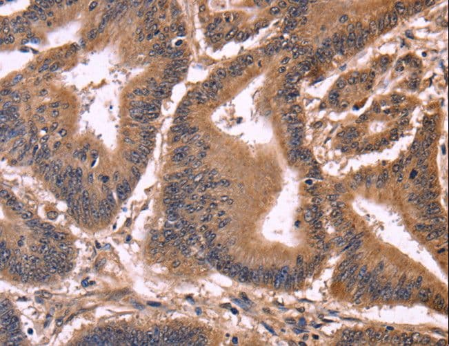CCDC106 Antibody