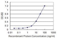 USP45 Antibody (clone 1H2)