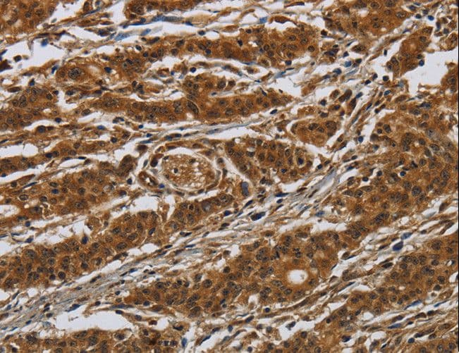 GATA5 Antibody